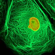 04 février : Journée Mondiale contre le cancer